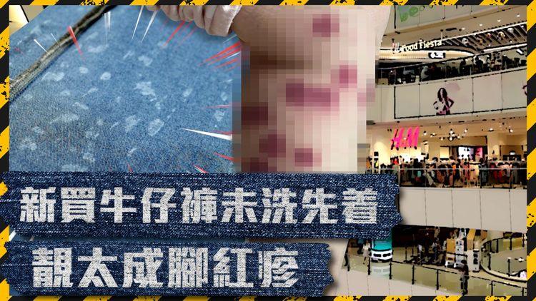 恐怖！靚太買H&M牛仔褲 著完疑似出滿疹痕到癲一撻撻！H&M派人收走條褲做化驗