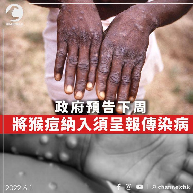 政府預告下周將猴痘納入須呈報傳染病 正籌備買疫苗藥物